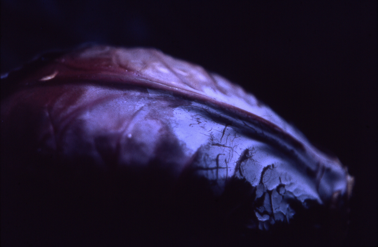101